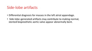 Side-lobe artifacts
• Differential diagnosis for masses in the left atrial appendage.
• Side-lobe–generated artifacts may contribute to making normal,
stented bioprosthetic aortic valve appear abnormally bent.
 