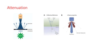 Attenuation
 