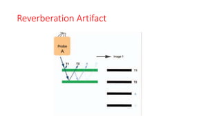 Reverberation Artifact
 