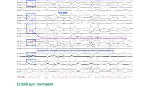 ARTIFACTS IN EEG.pptx