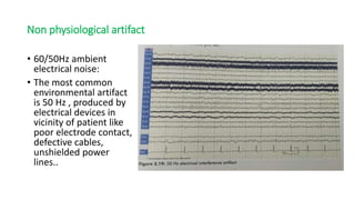 ARTIFACTS IN EEG.pptx