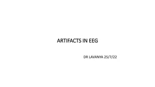 ARTIFACTS IN EEG
DR LAVANYA 25/7/22
 