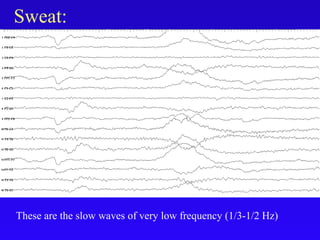 Sweat:
These are the slow waves of very low frequency (1/3-1/2 Hz)
 