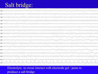 Salt bridge:
Electrolyte in sweat interact with electrode gel / paste to
produce a salt bridge
 