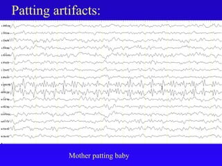 Patting artifacts:
Mother patting baby
 