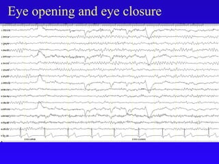 Eye opening and eye closure
 