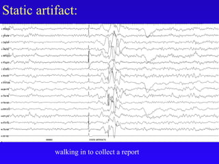 Static artifact:
walking in to collect a report
 