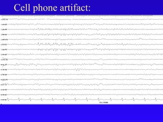 Cell phone artifact:
 
