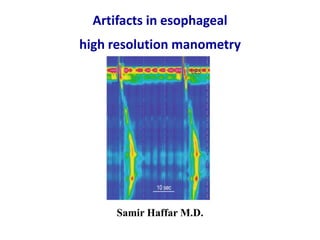 Artifacts in esophageal
high resolution manometry
Samir Haffar M.D.
 