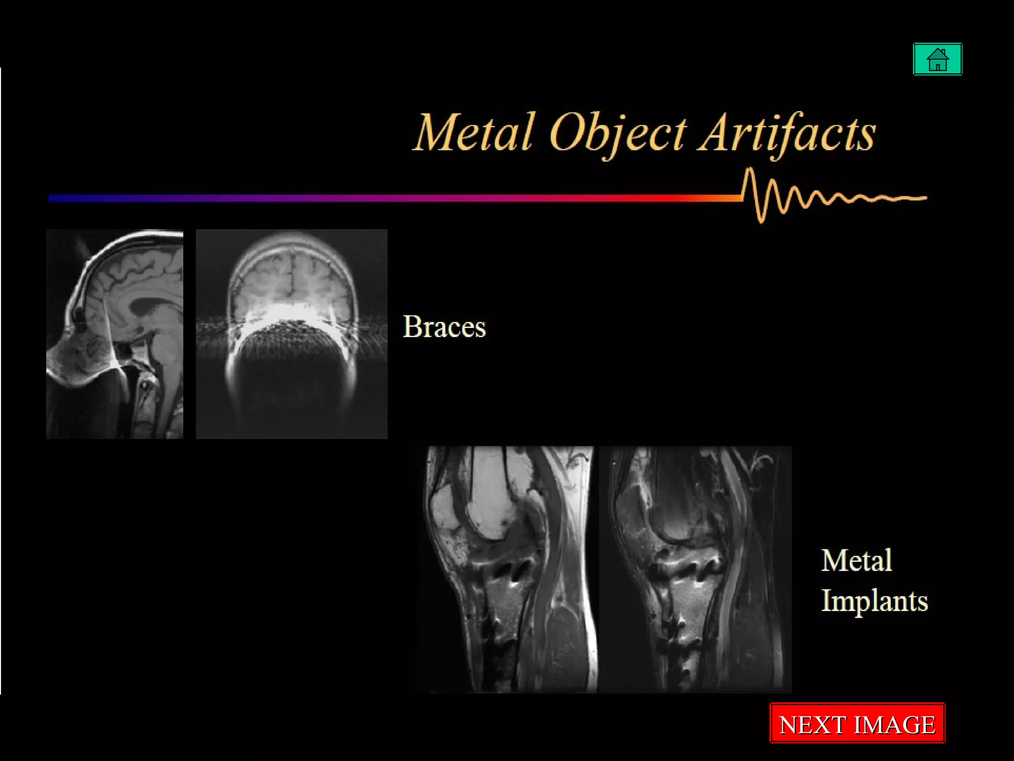 Artifacts in MRI | PPT