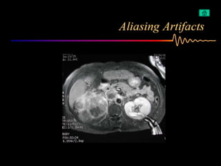 Artifacts in MRI | PPT