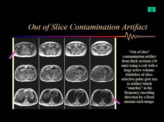 Artifacts in MRI | PPT | Chemistry | Science