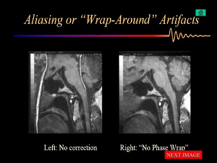 Artifacts in MRI