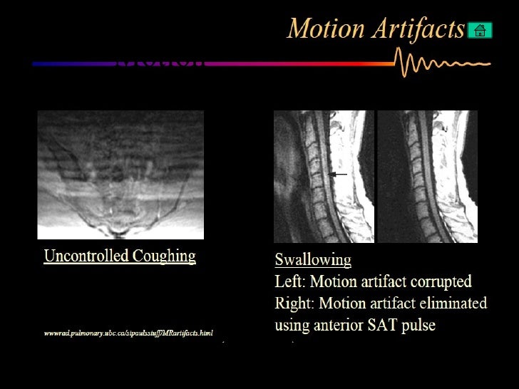 Artifacts in MRI