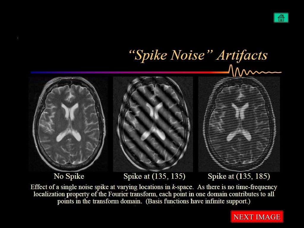 Artifacts in mri