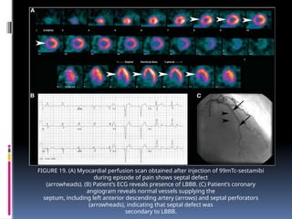 ARTIFACTS IN myocardial perfusion scan.pptx