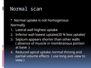 ARTIFACTS IN myocardial perfusion scan.pptx