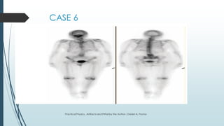 Artifacts in Nuclear Medicine with Identifying and resolving artifacts ...