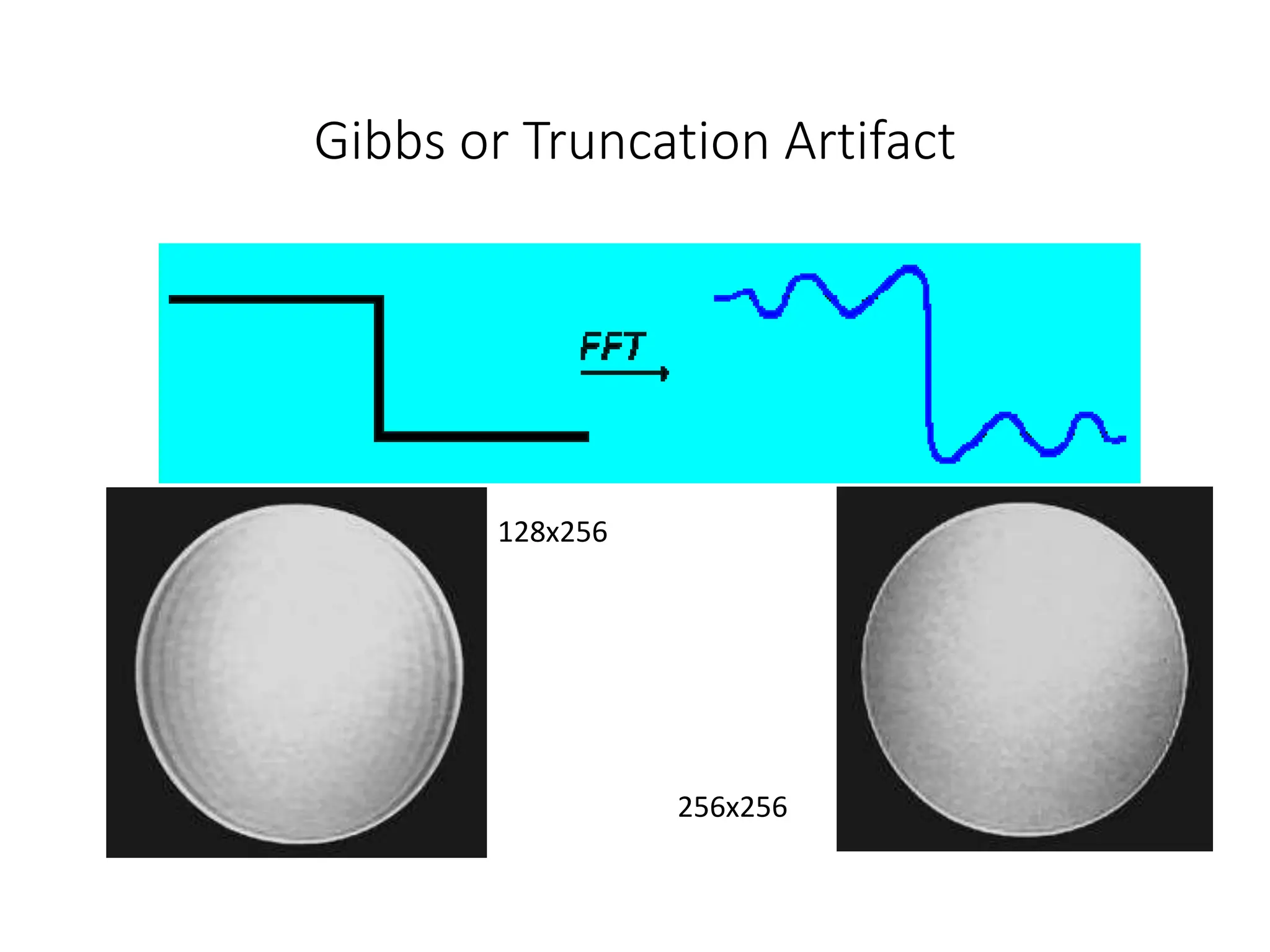 Gibbs or Truncation Artifact
128x256
256x256
 