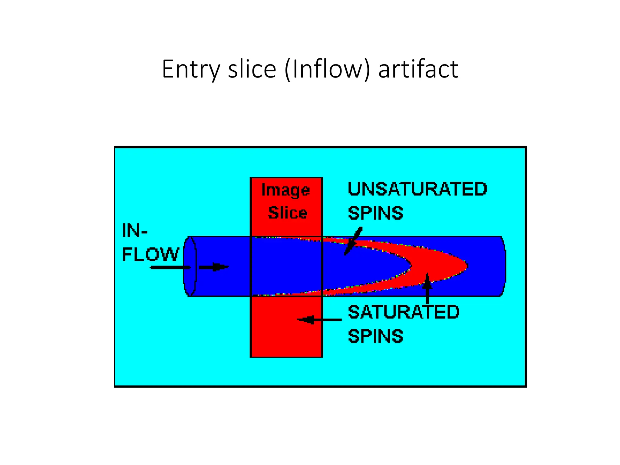 Entry slice (Inflow) artifact
 