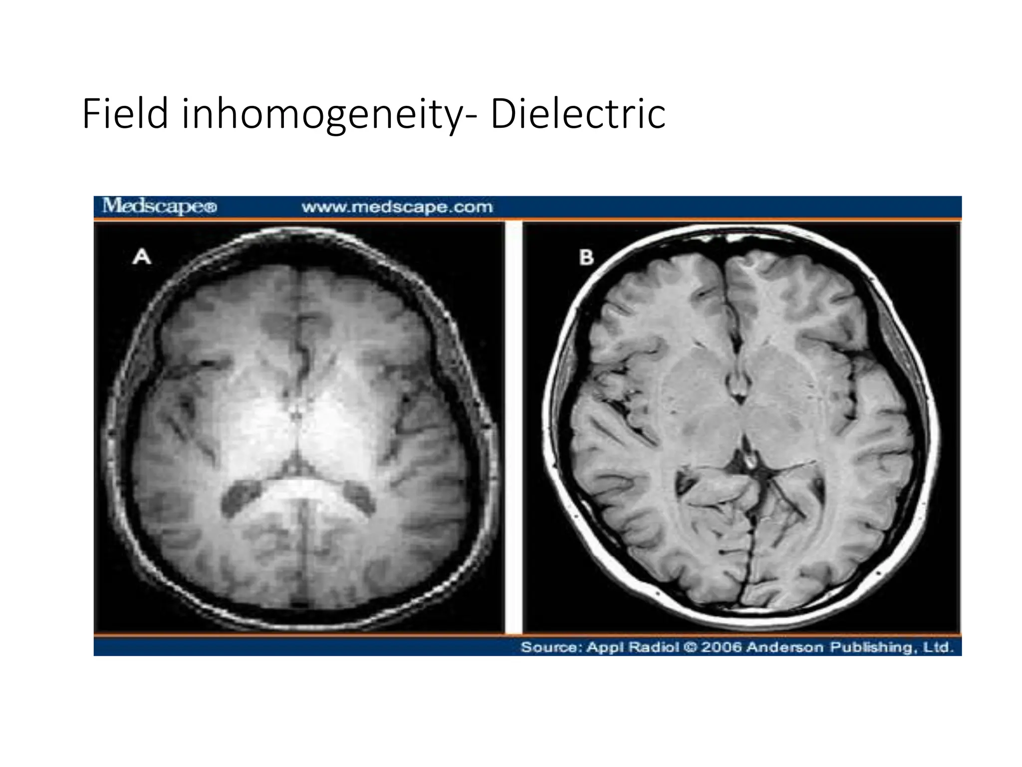 Field inhomogeneity- Dielectric
 