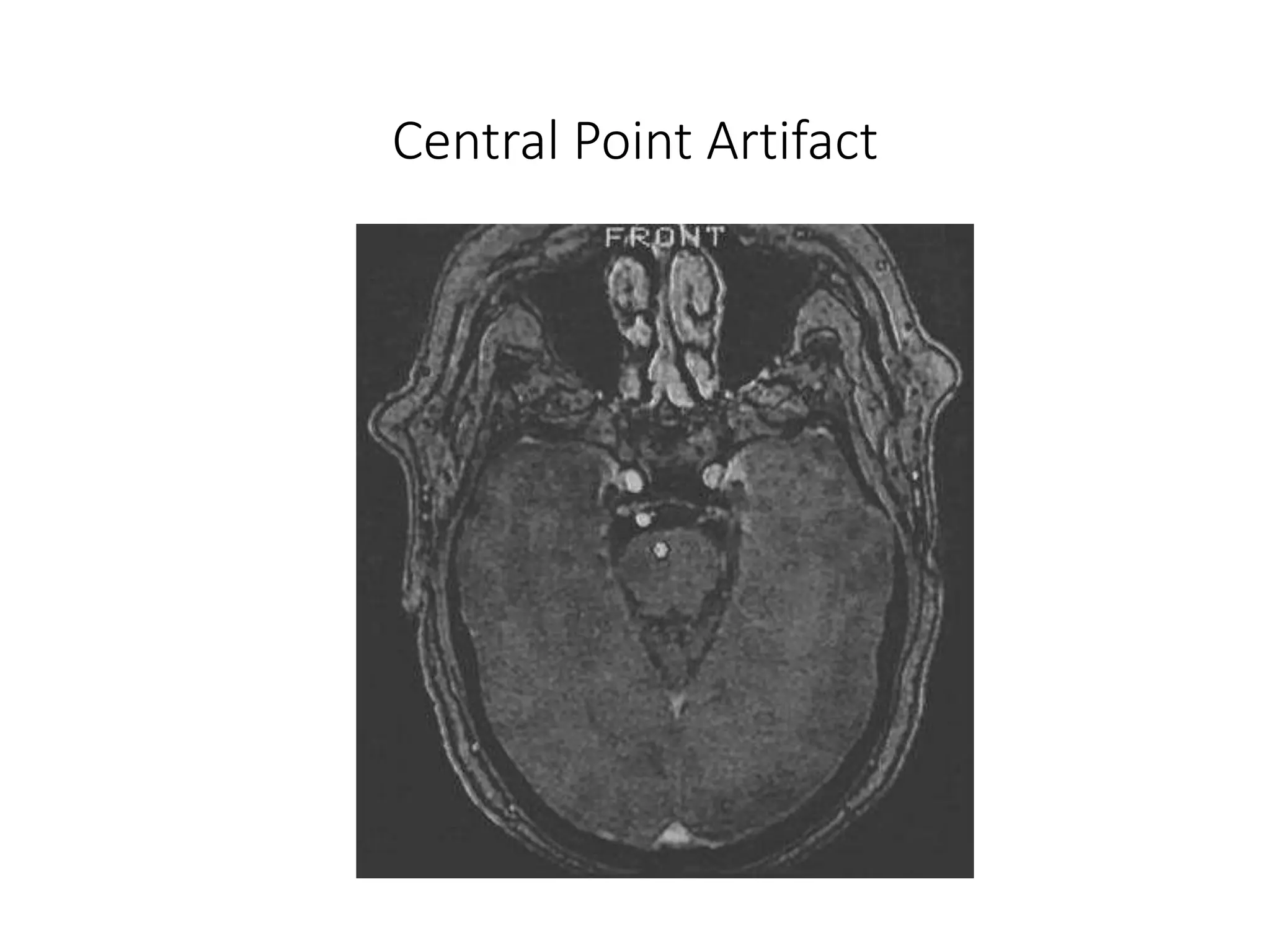 Central Point Artifact
 