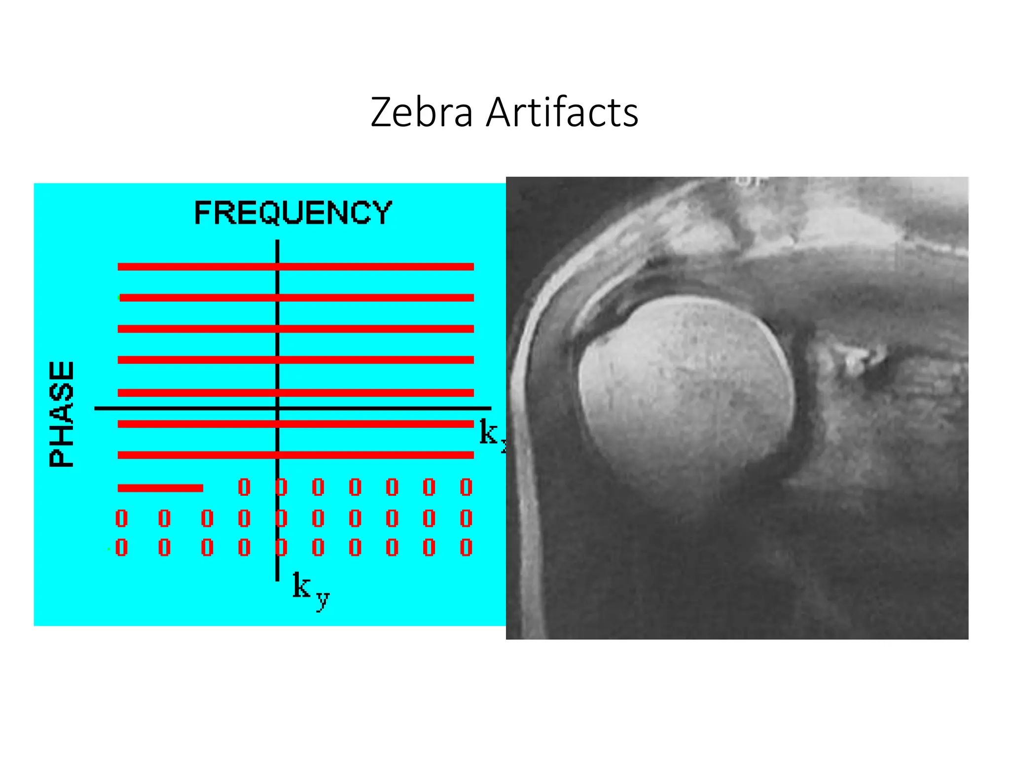 Zebra Artifacts
 