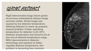 Basics concert of Artifacts of mammography | PPTX