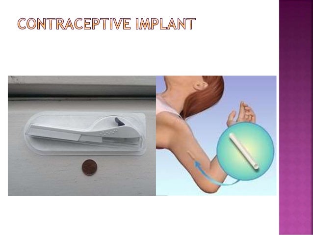 artificial-family-planning-methods