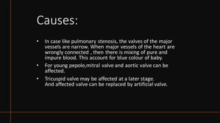 Causes:
• In case like pulmonary stenosis, the valves of the major
vessels are narrow. When major vessels of the heart are
wrongly connected , then there is mixing of pure and
impure blood. This account for blue colour of baby.
• For young pepole,mitral valve and aortic valve can be
affected.
• Tricuspid valve may be affected at a later stage.
And affected valve can be replaced by artificial valve.
 