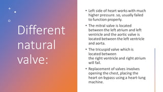 Different
natural
valve:
 