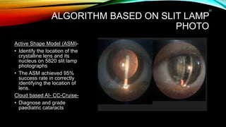 ALGORITHM BASED ON SLIT LAMP
PHOTO
Active Shape Model (ASM)-
• Identify the location of the
crystalline lens and its
nucleus on 5820 slit lamp
photographs
• The ASM achieved 95%
success rate in correctly
identifying the location of
lens.
Cloud based AI- CC-Cruise-
• Diagnose and grade
paediatric cataracts
22
 