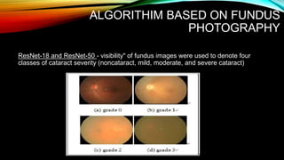ALGORITHIM BASED ON FUNDUS
PHOTOGRAPHY
ResNet-18 and ResNet-50 - visibility" of fundus images were used to denote four
classes of cataract severity (noncataract, mild, moderate, and severe cataract)
25
 