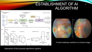 ESTABLISHMENT OF AI
ALGORITHM
28
Abstraction of the proposed algorithmic pipeline
Fundus heatmap overlaid on a fundus image
 
