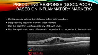 PREDICTING RESPONSE (GOOD/POOR)
BASED ON INFLAMMATORY MARKERS
• Uveitis macular edema: Annotation of inflammatory markers
• Deep learning algorithm to detect these markers
• Use this algorithm to differentiate b/w DME with UME.
• Use the algorithm to see a difference in responder & no responder to the treatment
38
 