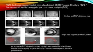 RNFL thickness maps extracted from all participant SS-OCT scans, Structural RNFL
features were identified using principal component analysis (PCA)
49
En face and RNFL thickness map
Bright area suggestive of RNFL defect
An accuracy of 93% (based on expert opinion) was reported for a hybrid deep
learning ANN analyzing single-scan SS-OCT data to classify eyes as normal or
glaucomatous
 
