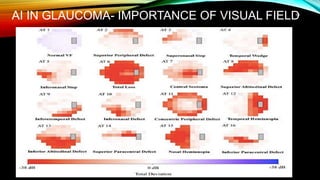 AI IN GLAUCOMA- IMPORTANCE OF VISUAL FIELD
50
 