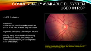 COMMERCIALLY AVAILABLE DL SYSTEM
USED IN ROP
• I-ROP DL algorithm
Limitations
•Convolutional neural networks are only as
robust as the data on which they are trained.
•System currently only classifies plus discase
•Ideally, a fully automated ROP screening
platform could classify zone, stage, and
overall disease category as well as predict
need for treatment.
JamesM. Brown et al; Automated Diagnosis of Plus Disease in Retinopathy of Prematurity
Using Deep Convolutional Neural Networks; JAMA Ophthalmol. 2018;136(7):803-810.
doi:10.1001/jamaophthalmol.2018.1934
57
 