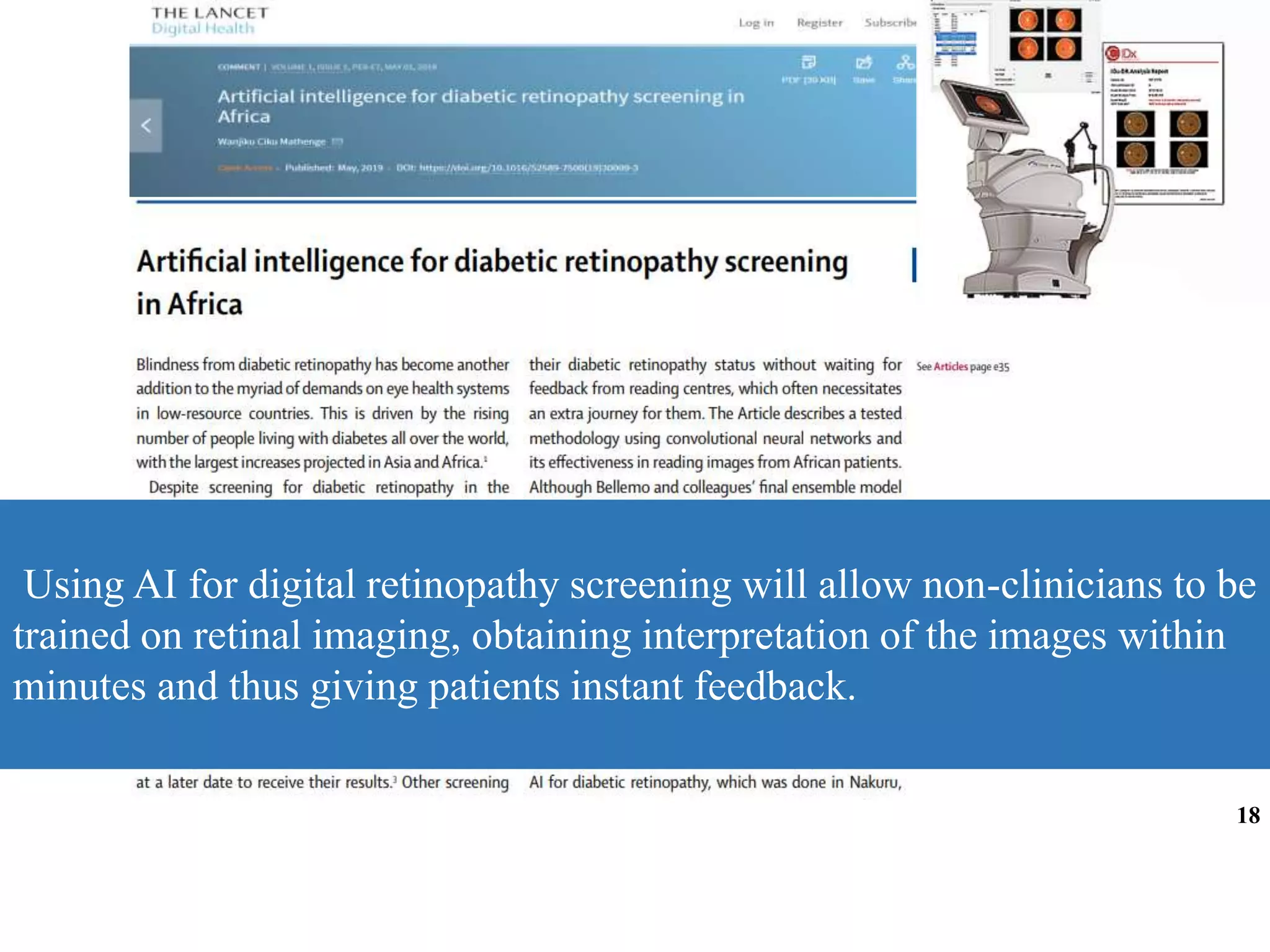 Using AI for digital retinopathy screening will allow non-clinicians to be
trained on retinal imaging, obtaining interpretation of the images within
minutes and thus giving patients instant feedback.
18
 