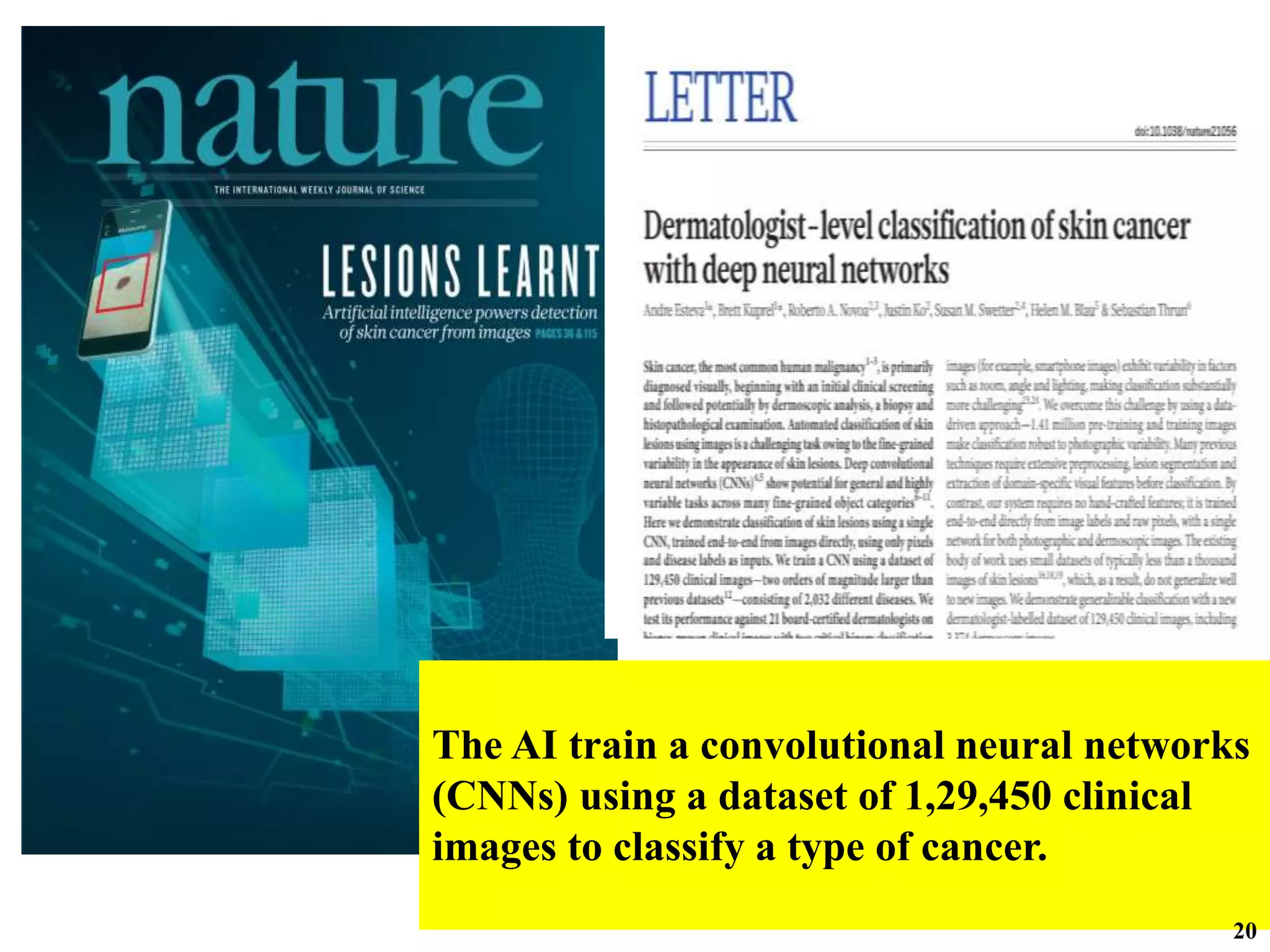 The AI train a convolutional neural networks
(CNNs) using a dataset of 1,29,450 clinical
images to classify a type of cancer.
20
 