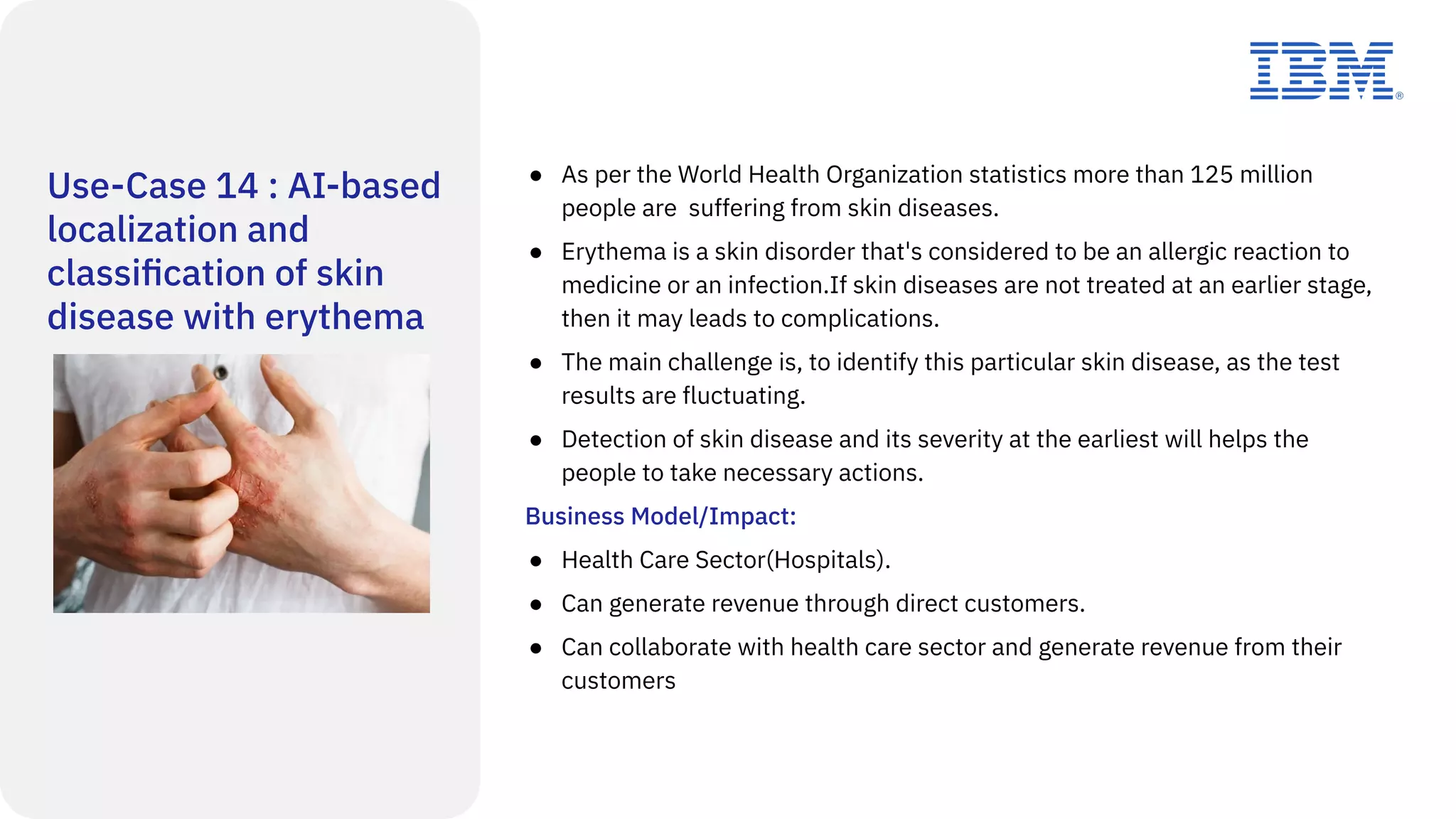 Use-Case 14 : AI-based
localization and
classiﬁcation of skin
disease with erythema
● As per the World Health Organization statistics more than 125 million
people are suffering from skin diseases.
● Erythema is a skin disorder that's considered to be an allergic reaction to
medicine or an infection.If skin diseases are not treated at an earlier stage,
then it may leads to complications.
● The main challenge is, to identify this particular skin disease, as the test
results are fluctuating.
● Detection of skin disease and its severity at the earliest will helps the
people to take necessary actions.
Business Model/Impact:
● Health Care Sector(Hospitals).
● Can generate revenue through direct customers.
● Can collaborate with health care sector and generate revenue from their
customers
 