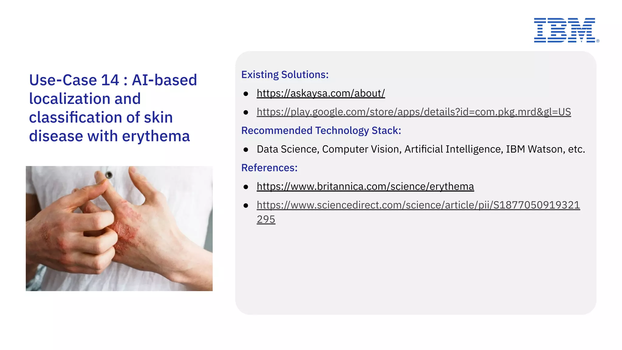 Existing Solutions:
● https://askaysa.com/about/
● https://play.google.com/store/apps/details?id=com.pkg.mrd&gl=US
Recommended Technology Stack:
● Data Science, Computer Vision, Artiﬁcial Intelligence, IBM Watson, etc.
References:
● https://www.britannica.com/science/erythema
● https://www.sciencedirect.com/science/article/pii/S1877050919321
295
Use-Case 14 : AI-based
localization and
classiﬁcation of skin
disease with erythema
 