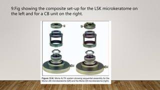 9.Fig showing the composite set-up for the LSK microkeratome on
the left and for a CB unit on the right.
 