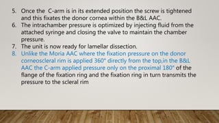 5. Once the C-arm is in its extended position the screw is tightened
and this fixates the donor cornea within the B&L AAC.
6. The intrachamber pressure is optimized by injecting fluid from the
attached syringe and closing the valve to maintain the chamber
pressure.
7. The unit is now ready for lamellar dissection.
8. Unlike the Moria AAC where the fixation pressure on the donor
corneoscleral rim is applied 360° directly from the top,in the B&L
AAC the C-arm applied pressure only on the proximal 180° of the
flange of the fixation ring and the fixation ring in turn transmits the
pressure to the scleral rim
 