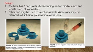 Design :
1. The base has 2 ports with silicone tubing: in-line pinch clamps and
female Luer-Lok connectors.
2. Either port may be used to inject or aspirate viscoelastic material,
balanced salt solution, preservation media, or air
 