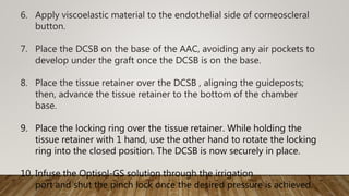 6. Apply viscoelastic material to the endothelial side of corneoscleral
button.
7. Place the DCSB on the base of the AAC, avoiding any air pockets to
develop under the graft once the DCSB is on the base.
8. Place the tissue retainer over the DCSB , aligning the guideposts;
then, advance the tissue retainer to the bottom of the chamber
base.
9. Place the locking ring over the tissue retainer. While holding the
tissue retainer with 1 hand, use the other hand to rotate the locking
ring into the closed position. The DCSB is now securely in place.
10. Infuse the Optisol-GS solution through the irrigation
port and shut the pinch lock once the desired pressure is achieved.
 