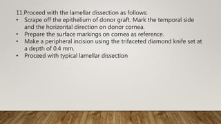 11.Proceed with the lamellar dissection as follows:
• Scrape off the epithelium of donor graft. Mark the temporal side
and the horizontal direction on donor cornea.
• Prepare the surface markings on cornea as reference.
• Make a peripheral incision using the trifaceted diamond knife set at
a depth of 0.4 mm.
• Proceed with typical lamellar dissection
 