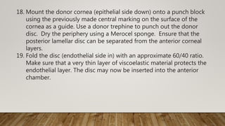 18. Mount the donor cornea (epithelial side down) onto a punch block
using the previously made central marking on the surface of the
cornea as a guide. Use a donor trephine to punch out the donor
disc. Dry the periphery using a Merocel sponge. Ensure that the
posterior lamellar disc can be separated from the anterior corneal
layers.
19. Fold the disc (endothelial side in) with an approximate 60/40 ratio.
Make sure that a very thin layer of viscoelastic material protects the
endothelial layer. The disc may now be inserted into the anterior
chamber.
 