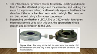 5. The intrachamber pressure can be titrated by injecting additional
fluid from the attached syringe into the chamber, and locking the
valve if the pressure is low, or alternatively aspirate fluid from the
chamber if the intrachamber pressure is too high. The pressure
can be checked using a Barraquer tonometer
6. Depending on whether a LSK(LASIK) or CB(Corrazio-Barraquer)
microkeratome is used with this unit, the appropriate ring is
chosen and screwed on to the unit.
 