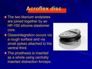 Acroflex disc
The two titanium endplates
are joined together by an
HP-100 silicone elastomer
core.
Osseointegration occurs via
a rough surface and via
small spikes attached to the
ventral third.
The prosthesis is inserted
as a whole using centrally
inserted distraction forceps.
 